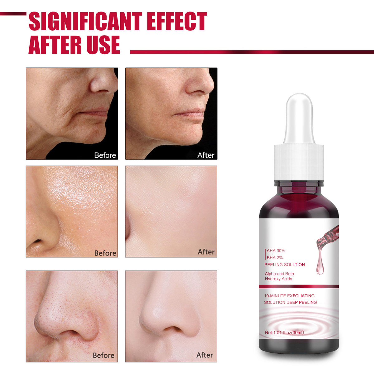 Salicylic Acid Exfoliating Serum — product photo 6